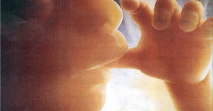 Neonata operata di cesareo: era incinta della gemella parassita