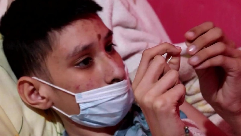 Questo ragazzo 14enne ha il cancro: per pagarsi le cure produce e vende bracciali
