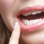 Covid, spunta un nuovo presunto sintomo preoccupante: riguarda i denti