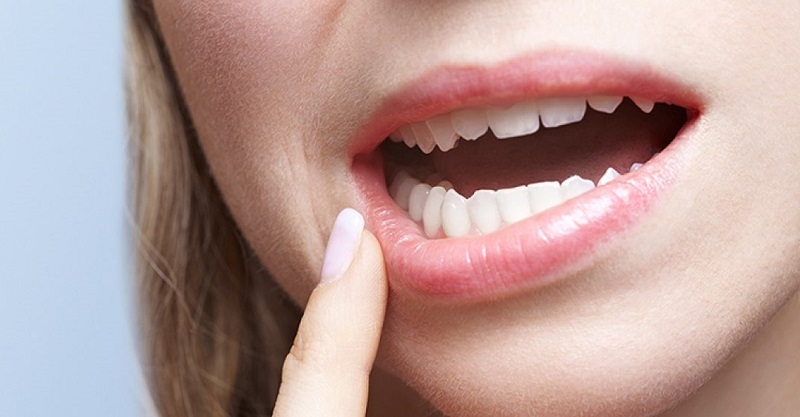 Covid, spunta un nuovo presunto sintomo preoccupante: riguarda i denti